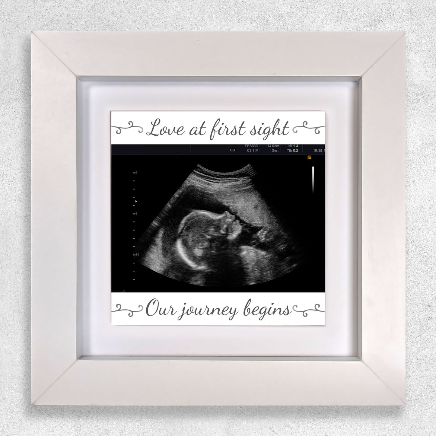 Baby Scan Gift – Love at First Sight Personalized Framed Ceramic Tile