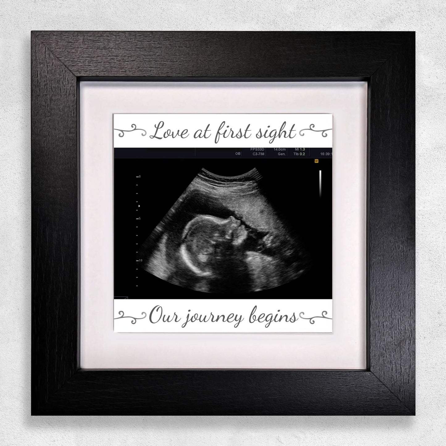 Baby Scan Gift – Love at First Sight Personalized Framed Ceramic Tile