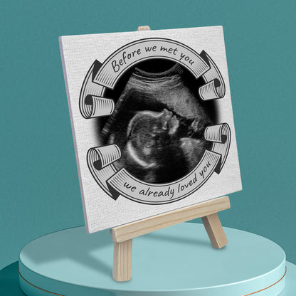 Baby Scan Gift – Before We Met You Personalized Tile with Easel