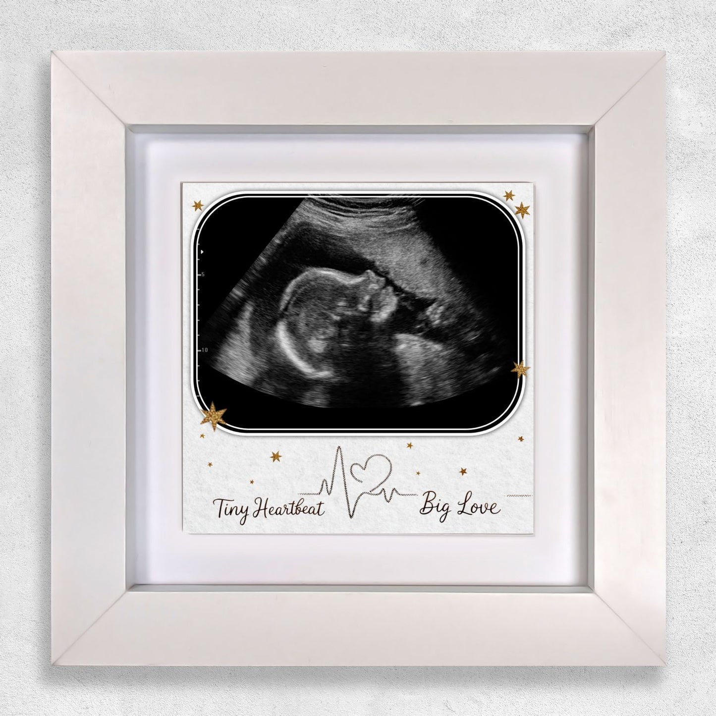 Baby Scan Gift – Tiny Heartbeat Big Love Personalized Framed Ceramic Tile
